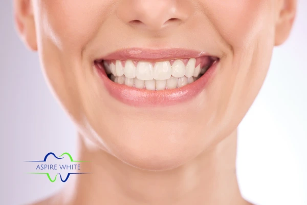 Follow your teeth whitening aftercare Bournemouth to prolong your whiter smile!