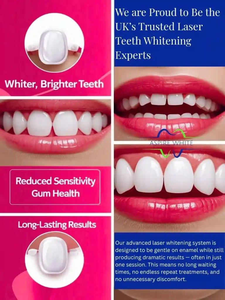 We are Proud to Be the UK’s Trusted Laser Teeth Whitening Experts Bournemouth